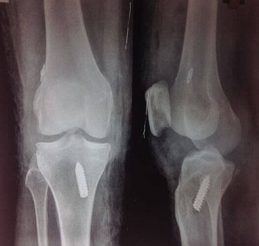 Orthopedic Services Chennai