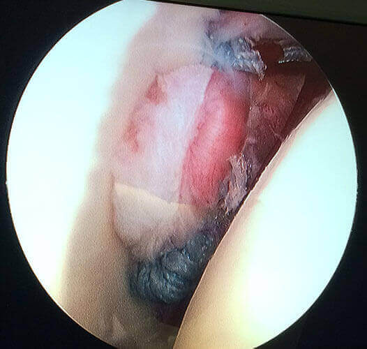 Knee Shoulder Hip Specialist Chennai