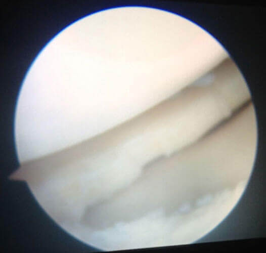 Buvana Ortho Clinic Gallery Chennai